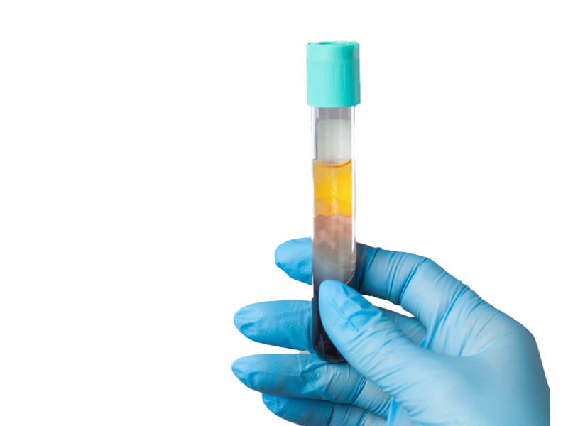 PRP